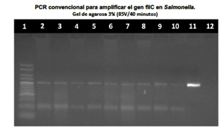 Electroforesis RT-PCR
