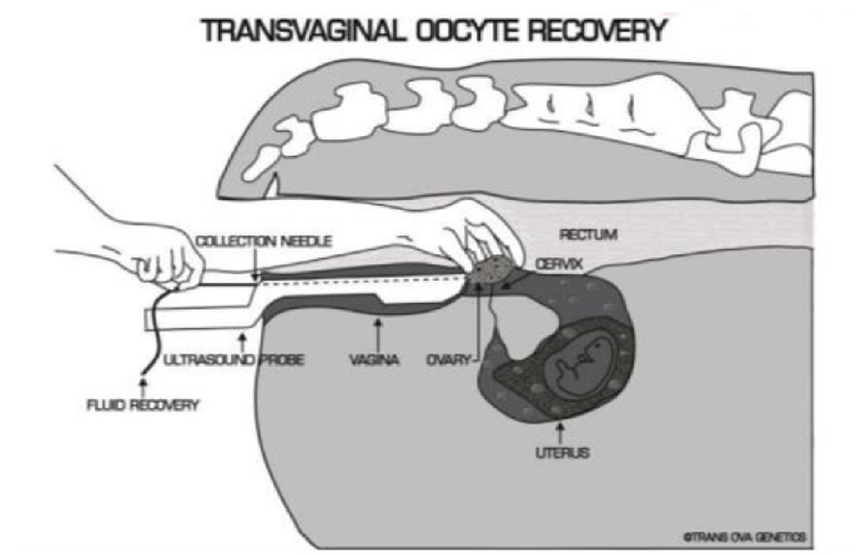Transvaginal oocyte