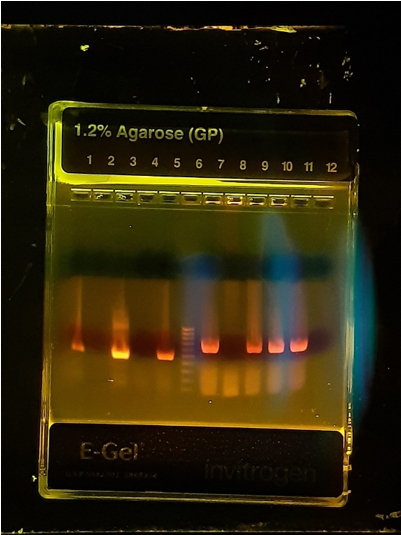 Gel de electroforesis